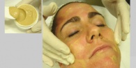 Cosmepeel: Peeling Facial versátil con fenol atenuado